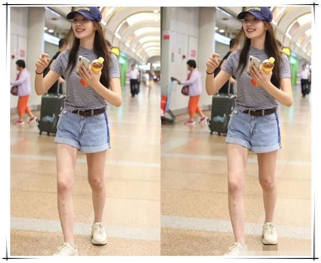 林允太奇葩了，满腿都是小疙瘩还敢穿短裤，网友:到底怎么想的?