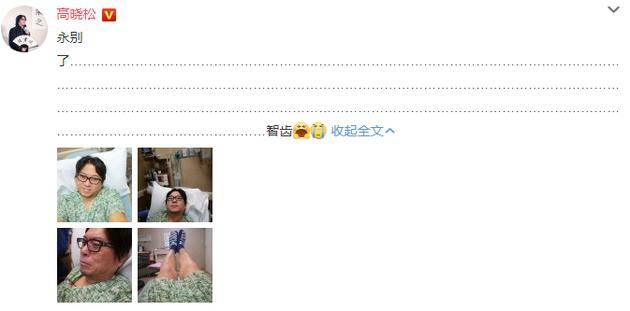 高晓松拔智齿被科普"不会瘦脸" 丁香医生还曾多次怼薛之谦