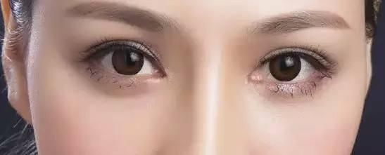 简单方便的双眼皮贴，你知道它是有危害的吗？