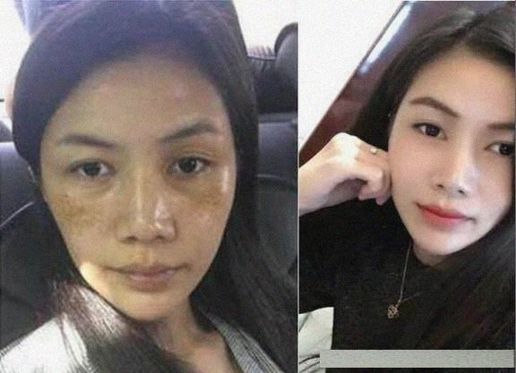 脸上长出了“老年斑”，教你1个简单的小技巧，她哭了“斑没了”