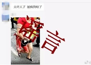 辟谣丨网传崇州一小孩腿部被狗咬掉 警方：视频系外地交通事故