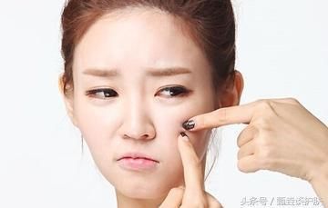 如何去除“闭口粉刺”