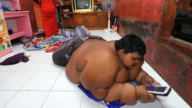 13岁男孩饭量普通四个人吃的那么多，体重400斤，父母还这样