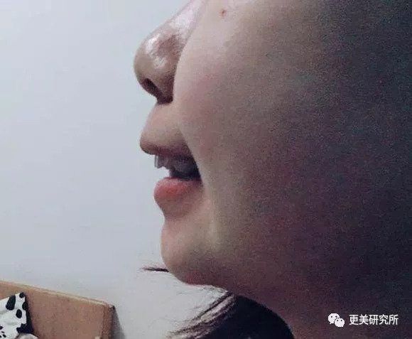 “整牙到底能不能瘦脸”终于有了权威结论，杨幂竟是被冤枉的?