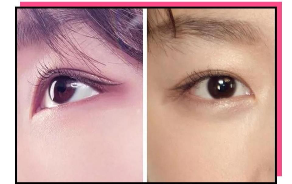 “你这个是肿眼泡，哭不出邓伦那样的双眼皮的。”