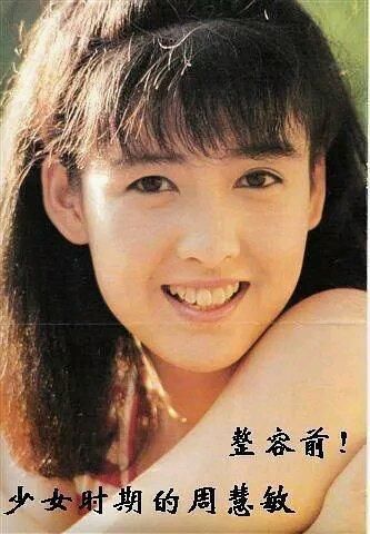 周慧敏整容谣言的来龙去脉