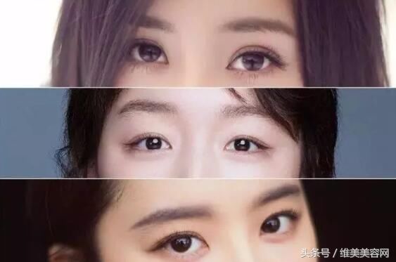 把单眼皮变成双眼皮，居然是这样做的