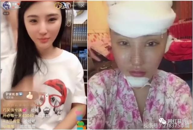 二驴爆出隐私手机号遭粉丝爆破无奈关机停用！平蓉开播力证未整容