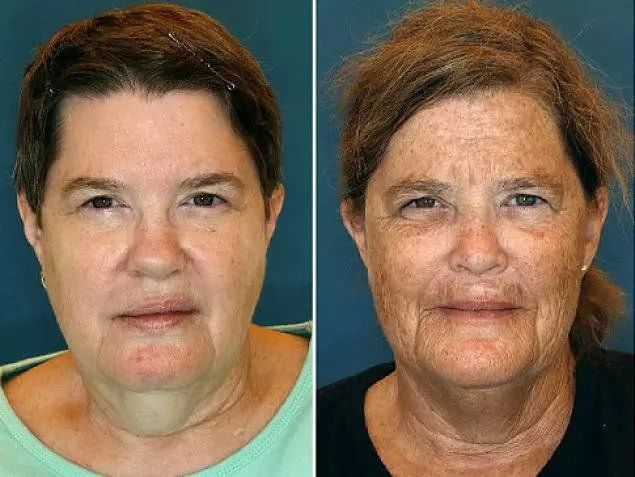 21岁的你拿什么拼过，51岁的周慧敏，48岁的莫文蔚，43岁的佘诗曼