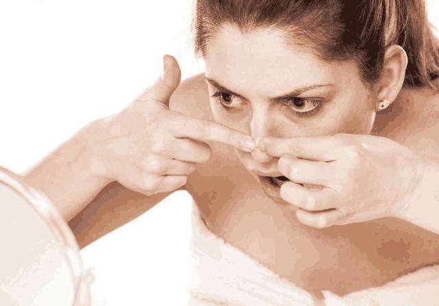 鼻子上黑头粉刺鼓鼓囊囊？用3招不撕不挤，黑头粉刺“如雨落下”