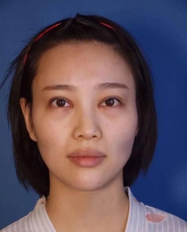  「看起来就」为什么做了整形也没有变好看