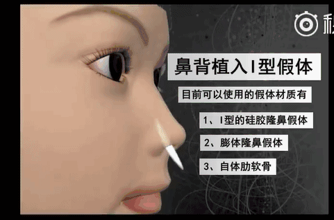  『和医生』隆鼻有哪些副作用？小心这5大后遗症等着你