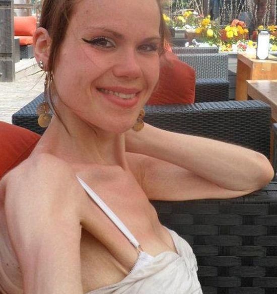 她意识到健康问题后,用了3年减肥,减掉280斤又增肥47斤?