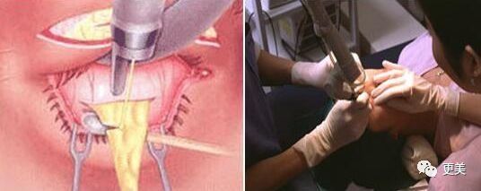 90后的郑爽关晓彤眼袋都要掉地上了，快来个医生救救她们吧!