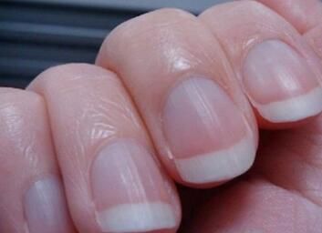 老中医: 手指甲出现竖纹或横纹, 说明你的身体出