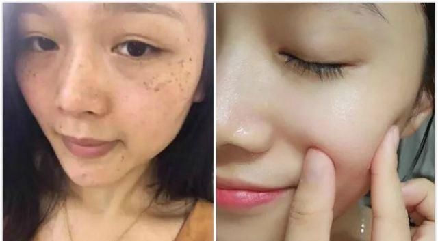  『显老』人到中年肌肤暗黄、色斑又显老,每天涂面霜能延缓吗?