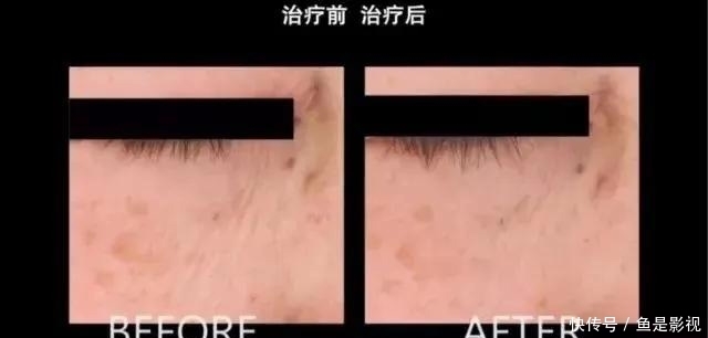  『产品』护肤品越贵就是越好？纪录片告诉你，可能只是在浪费钱!