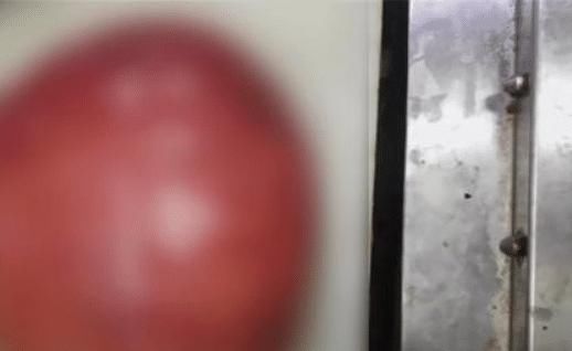  [患者王先生]男子恶心咳嗽，3个月后就医检查：胸腔中藏8斤肉瘤