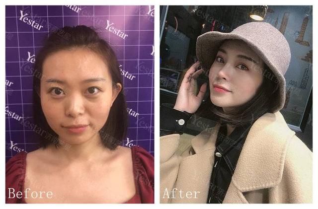 『讲解』决定颜值的是眼睛,还是鼻子?超全讲解在这里