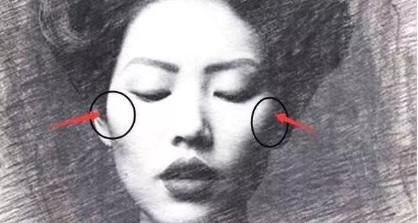  『事儿』颧骨颧弓整形那些事儿