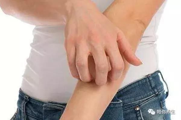 夏天手心发热 才不是正常现象 还可能是这6种