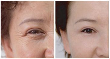 110岁姥姥:睡前抹点厨房”小东西“，用了眼袋、皱纹全不找