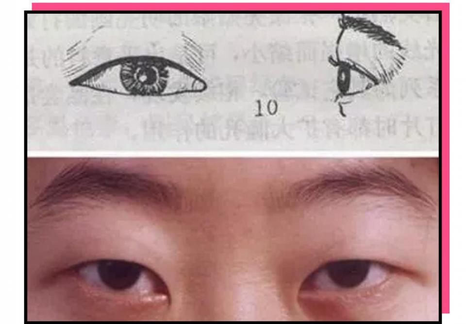 “你这个是肿眼泡，哭不出邓伦那样的双眼皮的。”