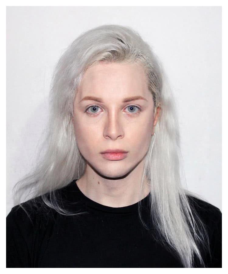 嫌人类丑，男孩花巨款将自己整形成了精灵，是绝美还是惊悚