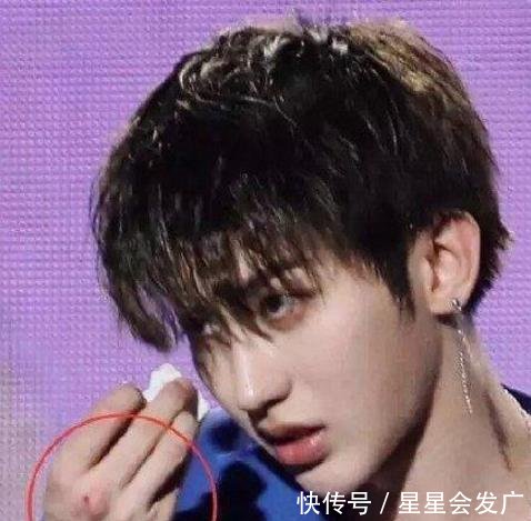 黑粉到底有多可怕千玺被寄假肢，杨幂气得大哭，他伤到了眼睛！