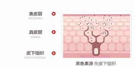  黑色素■激光美白真的有用么？上周我去亲身体验了一次