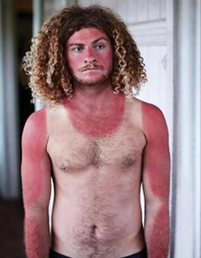 英国100年来最热夏天？别再去晒日光浴了！