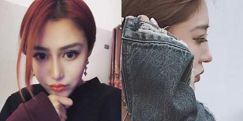  #术后恢复#为什么说春季是医美旺季？最适合整形项目大盘点，必看！