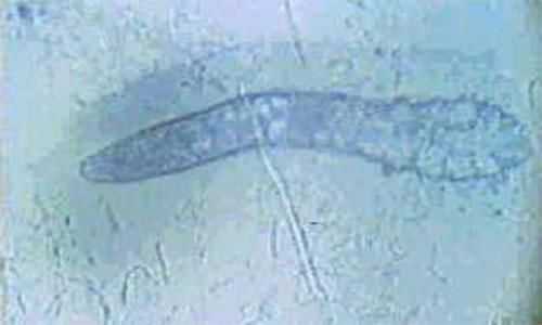 如果你后背上有这4大动静，毛囊里一定挤满了螨虫，3方法排干净