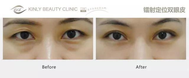 传周迅高圣远分居将要离婚?娱乐圈对女人到底有多残酷?为了戏路更