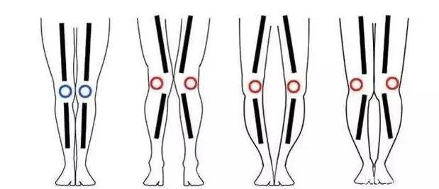 为什么日本女生大多都是O型腿？原因竟让人大开眼界！