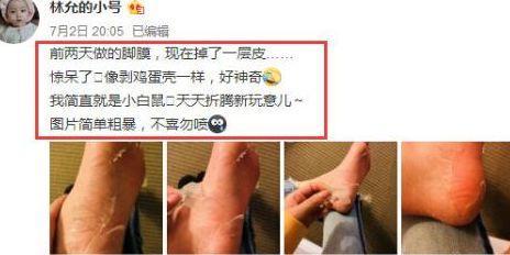 夏日护足行动start，你也想被王凯捧在手心吗？