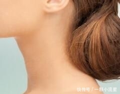 『注射除皱后』颈部打玻尿酸多少钱