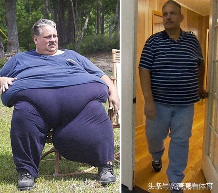 这群体重超过500斤的人仍回归正常,减肥堪比整容!