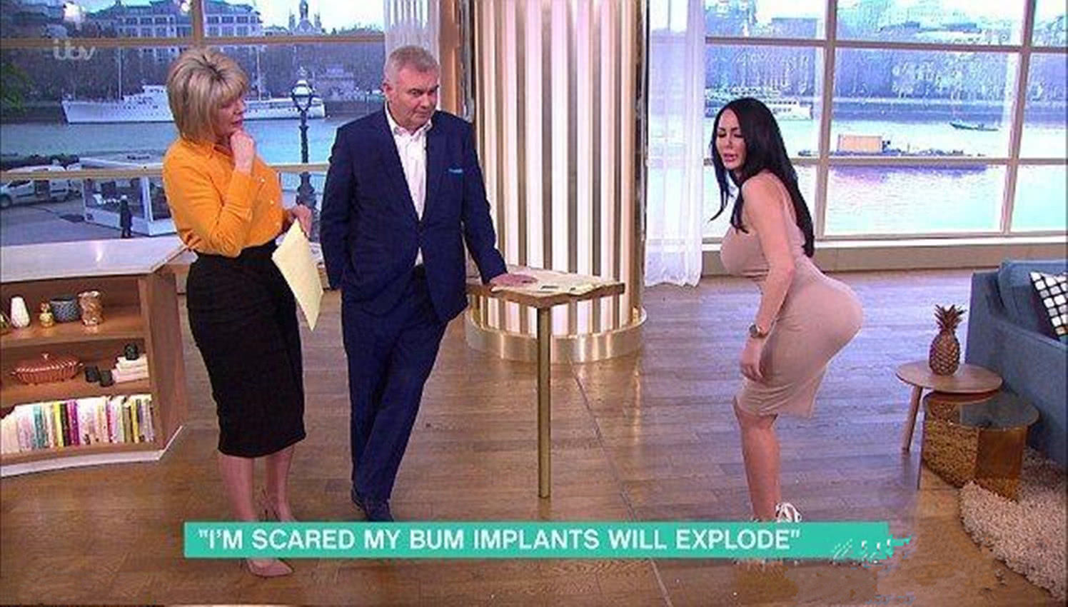 女子花费近14万整容，“只能站不能做”担心填充物会爆炸