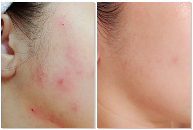 51岁周慧敏美到刷屏，逃不过渣男的她，人生比宫斗剧还精彩!