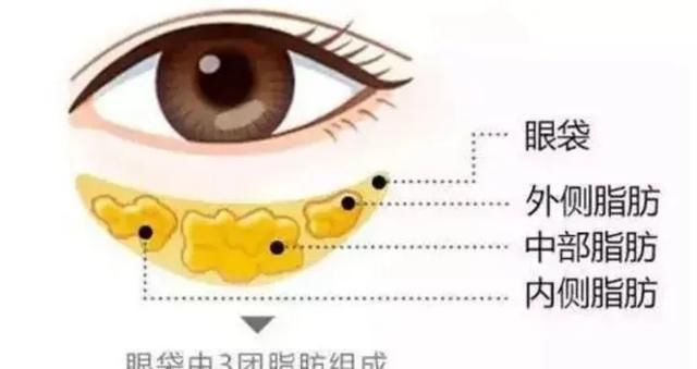  百科@瘦百科18小黑盒：遮不住的眼袋到底该怎么办？