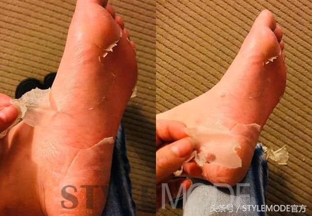 看脚时代，不完美到脚趾怎配穿凉鞋！