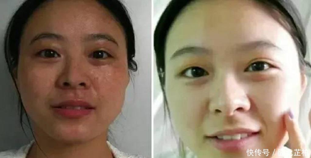 『省钱』柠檬加“它”来敷脸,一个月色斑、皱纹变淡不少,简单好用又省钱