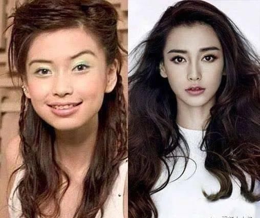  「好看」鼻子做成什么样才好看，一篇务实的鼻修复参考（三）|日本医美