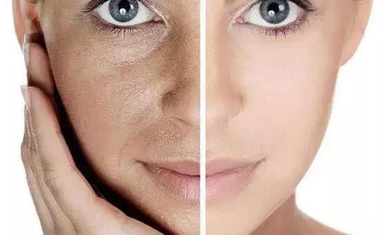 晒后“烤”验！把握晒后修复黄金时段！黑了也能白回来！