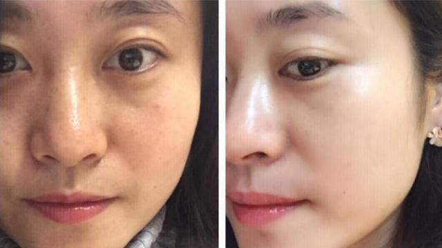  洗面奶@你的洗面奶上黑名单了吗?用了会“烂脸”,小心皮肤越来越差!