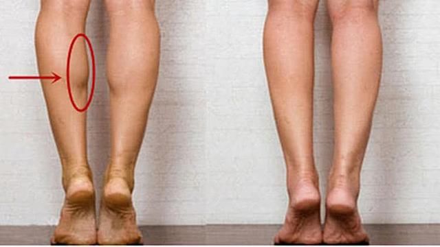 夏日露腿的季节，女生想瘦腿先改掉5个习惯，尤其第一个