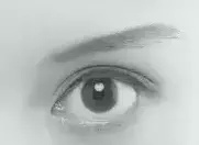 北京八大处杨欣专家:双眼皮术式该怎么选