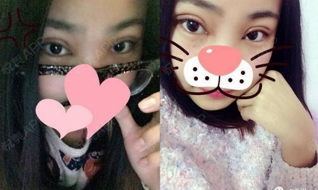 『眼睛』什么样的眼,能成就一张高级脸?|案例