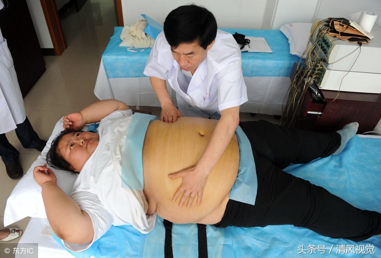 32岁姑娘体重356斤，会2门外语就业受歧视，按摩减肥欲找男友